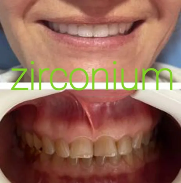 Alanya HEALTHY TEETH Dental Aesthetic — Léky v Alanyi: Online objednávka, ceny a recenze