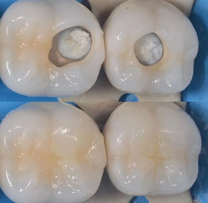 Alanya HEALTHY TEETH Dental Aesthetic — Léky v Alanyi: Online objednávka, ceny a recenze