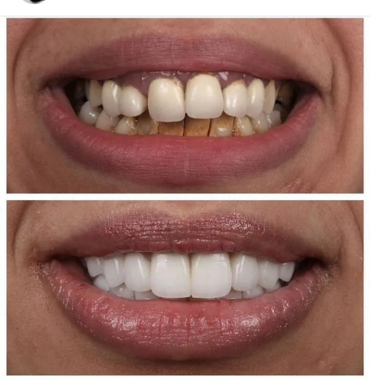 Alanya HEALTHY TEETH Dental Aesthetic — Léky v Alanyi: Online objednávka, ceny a recenze