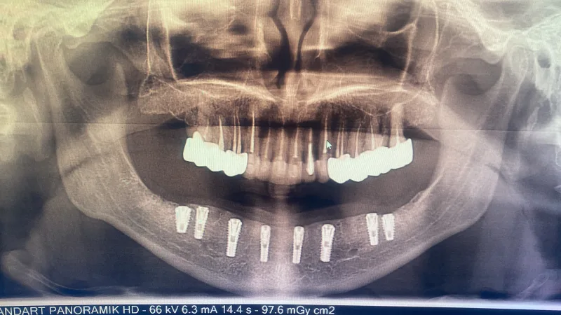 Alanya HEALTHY TEETH Dental Aesthetic — Léky v Alanyi: Online objednávka, ceny a recenze