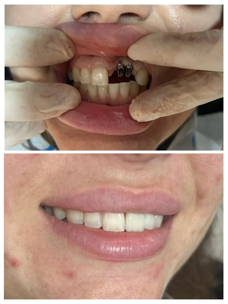 Alanya HEALTHY TEETH Dental Aesthetic — Léky v Alanyi: Online objednávka, ceny a recenze
