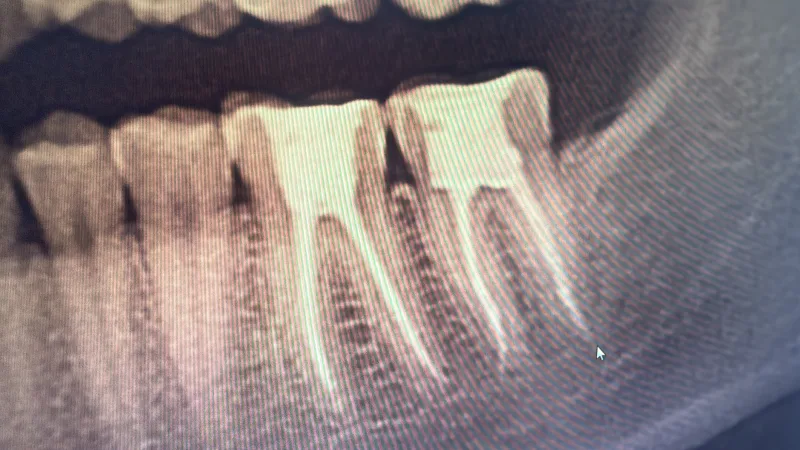 Alanya HEALTHY TEETH Dental Aesthetic — Léky v Alanyi: Online objednávka, ceny a recenze