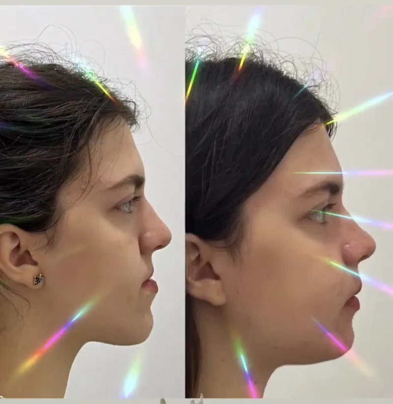 Alanya HEALTHY TEETH Dental Aesthetic — Léky v Alanyi: Online objednávka, ceny a recenze